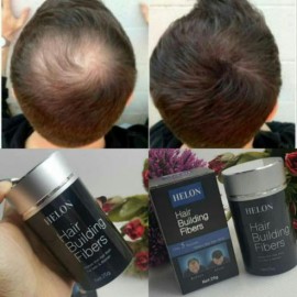 بودرة تعبئة فراغات الشعر متوفرة بعدة الوان بودرة تعبئة فراغات الشعر متوفرة بعدة الوان