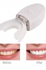 جهاز تبييض الاسنان الطبي بالليزر